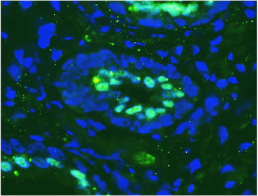 Glandular architecture of benign prostate: Luminal layer marked by fluorescent immuno-histochemical detection of NKX3.1 (green) with nuclei couterstained in DAPI (blue)